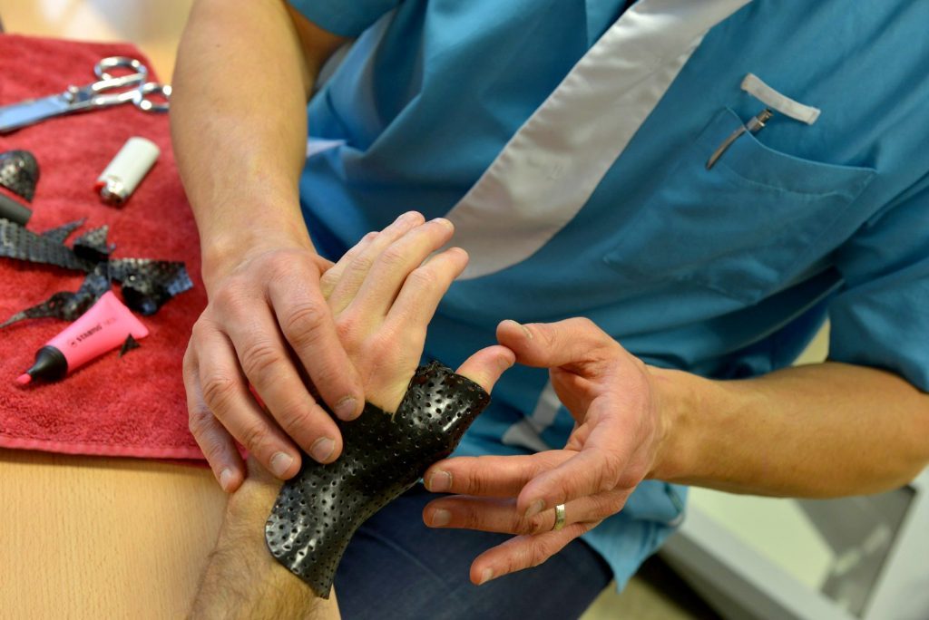 Orthèse de main sur mesure moulée directement sur le patient - Remboursement par sécurité sociale sur ordonnance médicale